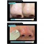 ILSO – Super Melting Sebum Softener | Pore-Refining Glow - Image 5