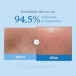 MEDICUBE – Zero Pore Blackhead Deep Cleansing Oil | Blackhead Removal - Image 2
