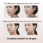 MARSHIQUE – Line Lifting Hydrogel Smile Line Patch - Image 9